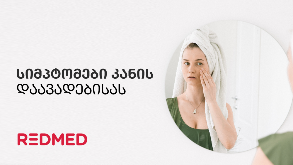 კანის გავრცელებული დაავადებები