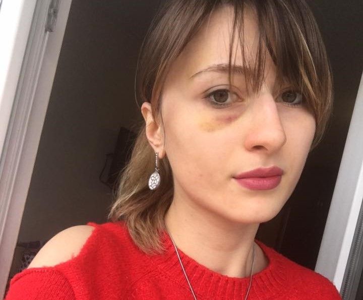 დეა გოშხეთლიანი ყოფილი მეუღლის მხარეს სიტყვის თავისუფლების შეზღუდვის მცდელობაში ადანაშაულებს