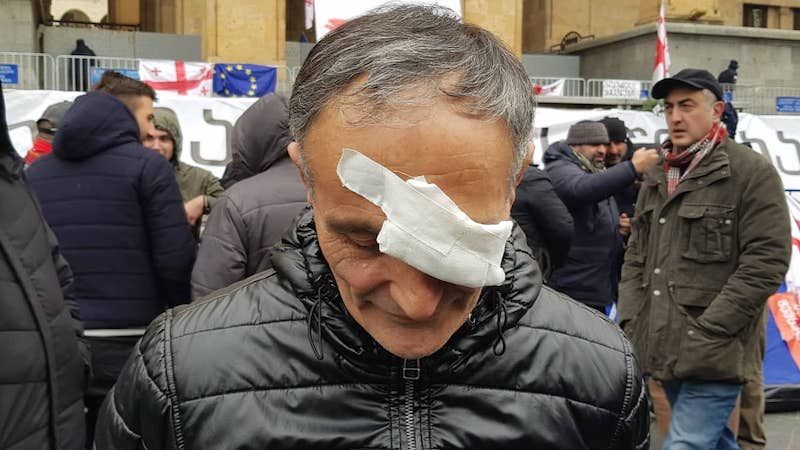 “მე არავის მოვთხოვ თვალს, ჩემი სამშობლოსთვის ყველაფერი ზვარაკად შემიწირია”-ზაზა ლიპარტელიანი